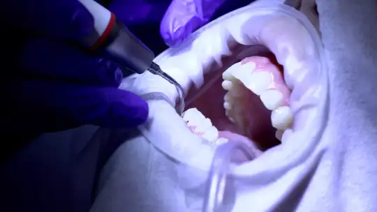 Zapobiegaj, nie lecz: tajniki zdrowej jamy ustnej z Dominiką Jordan